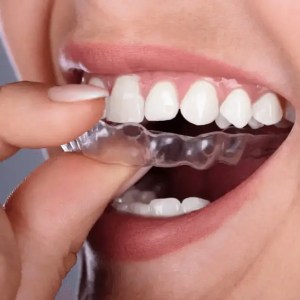 mejor dentista en miami, carillas de porcelana en miami, Botox miami, costo del tratamiento de conducto en miami, elevación de seno nasal en miami, mejores carillas en miami, mejor dentista del sur de florida, mejor dentista cosmético en miami, mejor atención dental en miami, sage dental