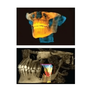 mejor dentista en miami, carillas de porcelana en miami, Botox miami, costo del tratamiento de conducto en miami, elevación de seno nasal en miami, mejores carillas en miami, mejor dentista del sur de florida, mejor dentista cosmético en miami, mejor atención dental en miami, sage dental